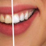 naturally whitening teeth